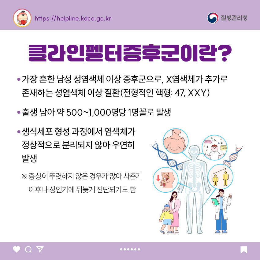 클라인펠터증후군이란? - 가장 흔한 남성 성염색체 이상 증후군으로, X염색체가 추가로 존재하는 성염색체 이상 질환(전형적인 핵형: 47, XXY) - 출생 남아 약 500~1,000명당 1명꼴로 발생 - 생식세포 형성 과정에서 염색체가 정상적으로 분리되지 않아 우연히 발생 ※ 증상이 뚜렷하지 않은 경우가 많아 사춘기 이후나 성인기에 뒤늦게 진단되기도 함